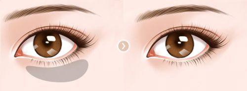 无锡康洹整形医院预约挂号方式：