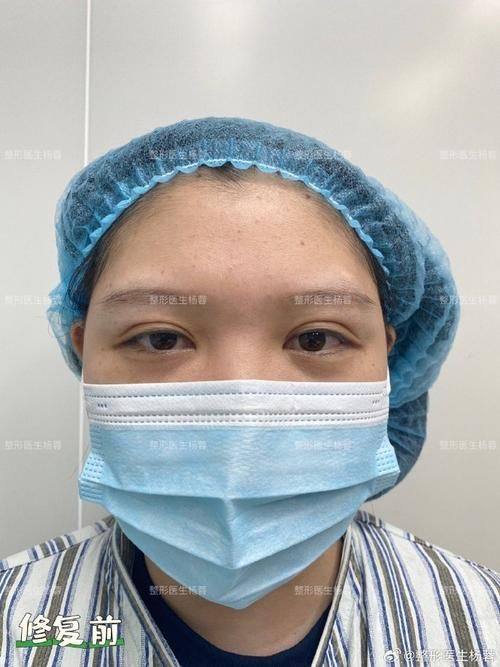 东北国内外医院整形美容再生医学中 心价格表：