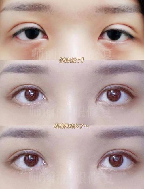 韩国狎鸥亭STORY整形外科 