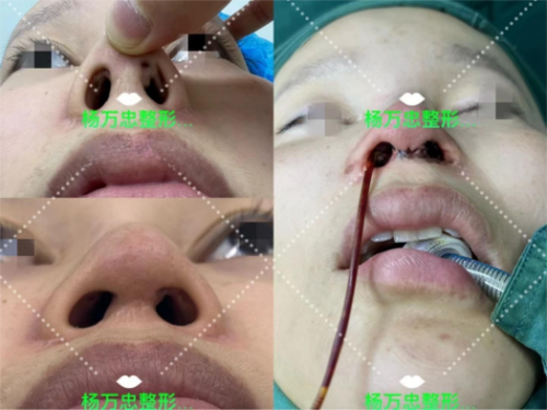韩国狎鸥亭STORY整形外科 