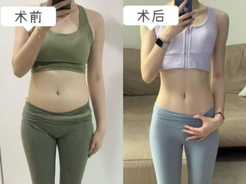 日本宫本形成外科医院价格表：