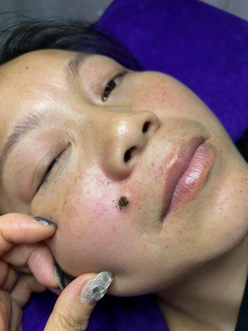 普洱现代医学整形美容门诊部预约挂号方式