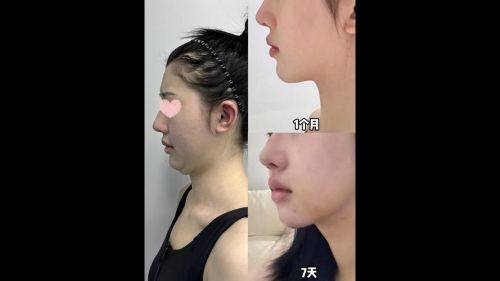 普洱现代医学整形美容门诊部擅长项目：