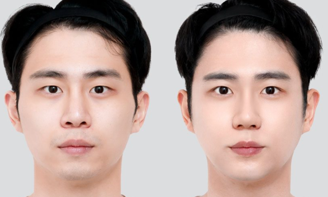 韩国狎鸥亭STORY整形外科 