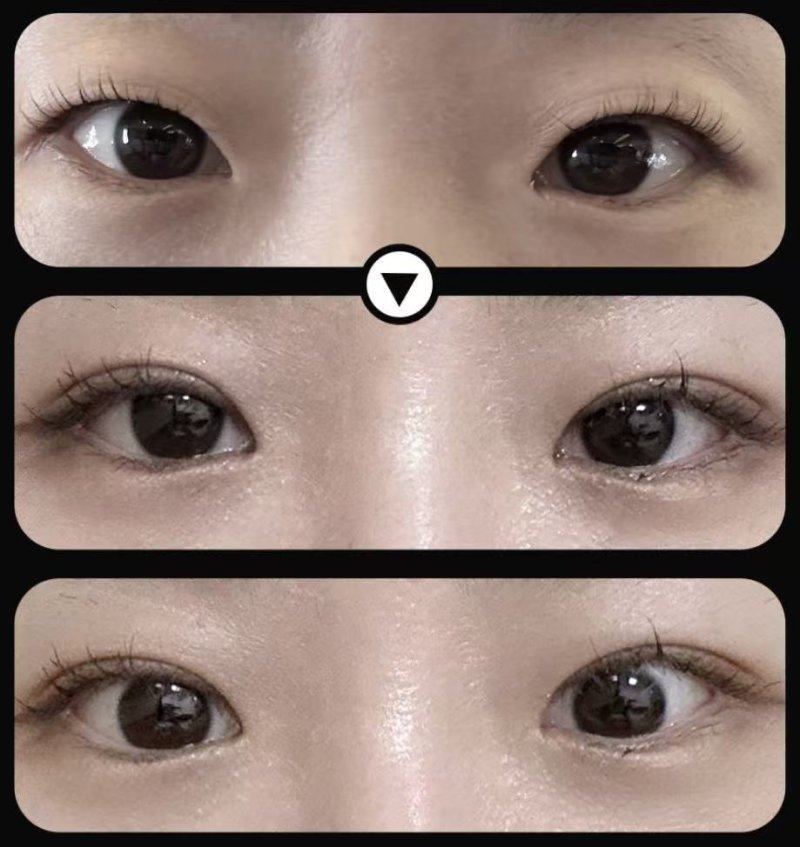 金华徐晓医疗美容诊所擅长项目