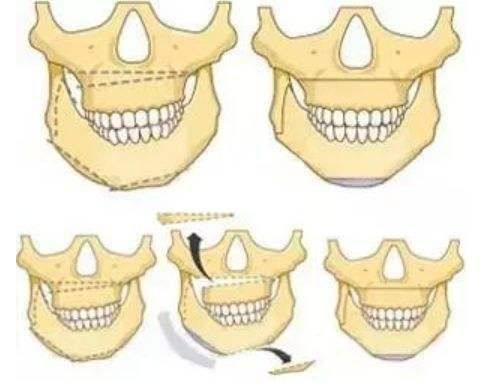 泸州杨氏牙科诊所口碑评价：