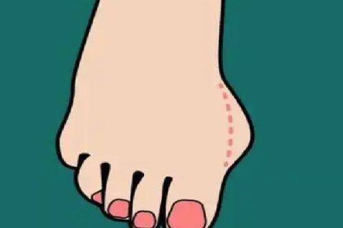 五、增生性疤痕、疤痕疙瘩：抑制增生+防复发双管齐下