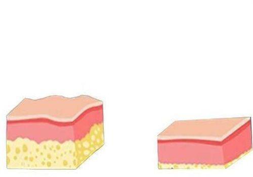 五、现在隆鼻的关键：医生选择与护理要点