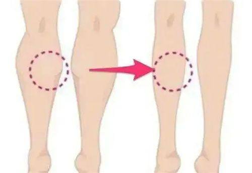 六、2024-2025隆鼻全新价格参考