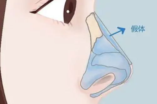 呼和浩特蕊儿医疗美容诊所擅长项目：