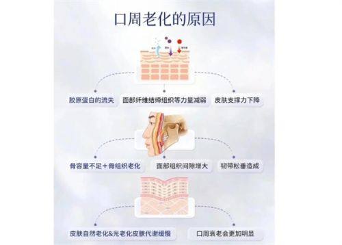 四、割双眼皮的放大局限：搭配开眼角成效更显著
