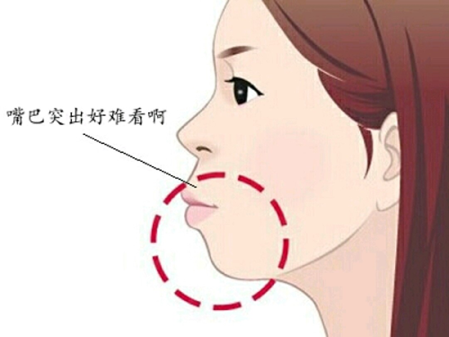 二、现在做隆鼻怎么做更好：匹配需求选对方案