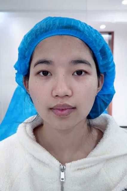 济南宣颜整形医院价格表