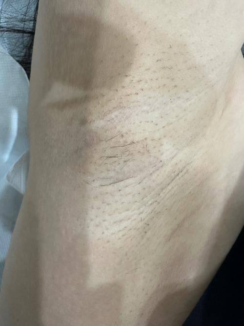 武汉南湖美之术医疗美容诊所价格表