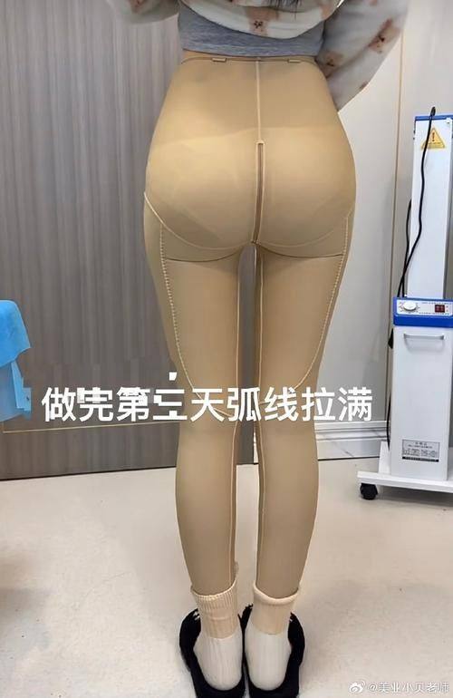 荥阳朵姿医疗美容诊所擅长项目：