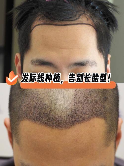 中山希妍整形医院擅长项目：