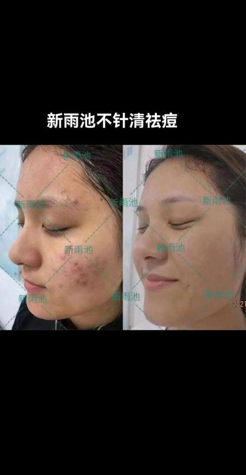 武汉南湖美之术医疗美容诊所预约挂号方式