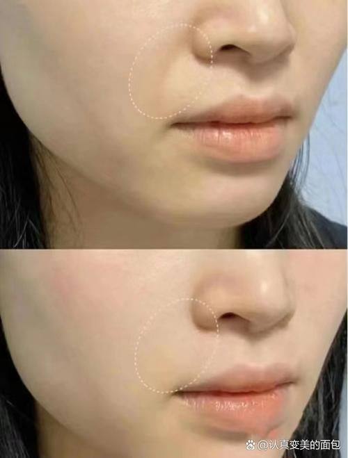 枣庄矿务局医院美容整形中 心价格表: