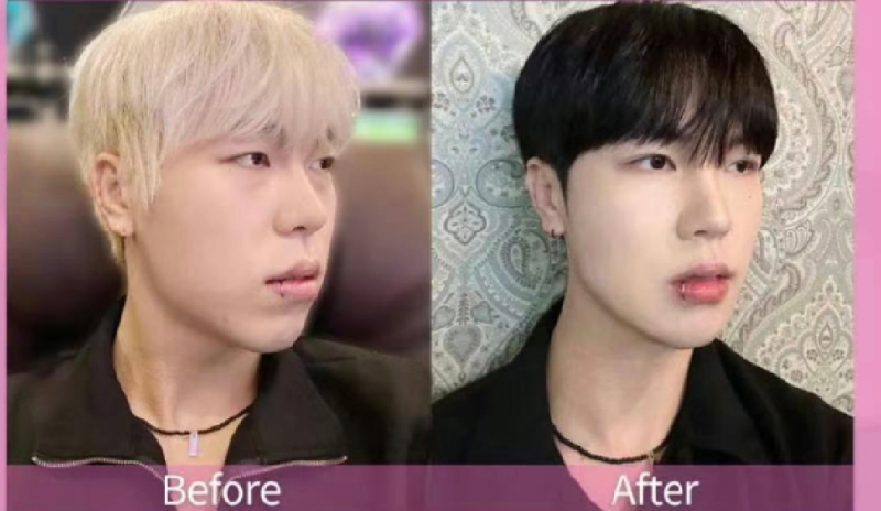 荥阳朵姿医疗美容诊所预约挂号方式