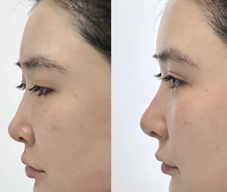 唐山真善美(原美仁)医疗美容诊所擅长项目: