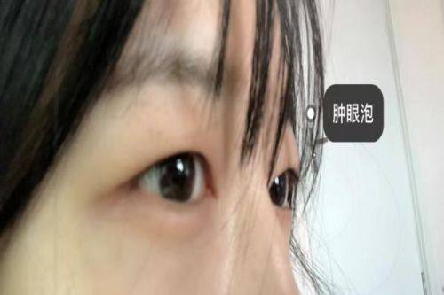 南京美尔恩医疗美容诊所预约挂号方式