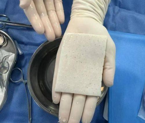 六、脸上有疤痕怎么才能去掉小妙招——日常辅助祛疤法