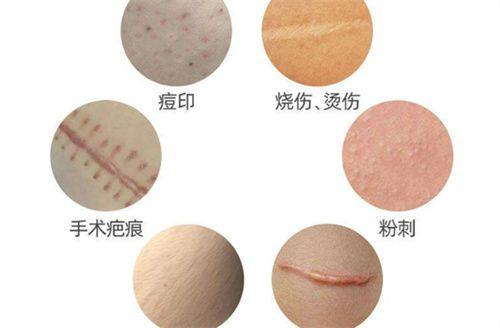 五、术后6个月以上：精细修复，解决根源问题