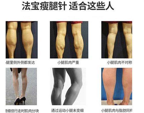 三、鼻子两边疤痕护理的小妙招