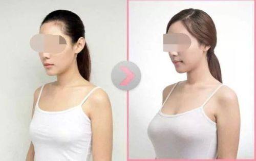 平顶山友谊整形医院口碑评价：