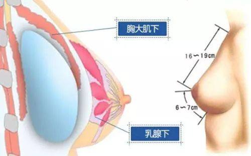 五、男生割双眼皮会留疤吗？成效保护要点要记牢