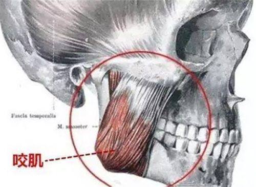 三、非正规机构用不可吸收线材：建议尽早取出，规避长期风险