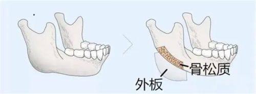 呼和浩特万诺医疗美容门诊部擅长项目: