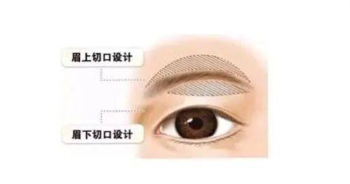 五、大面积面部疤痕的手术修复方案