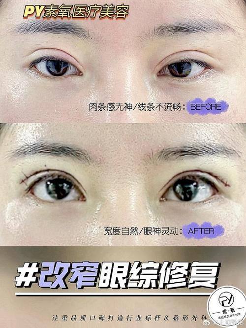 辽宁医学校附属第一医院烧伤整形科医生名单及擅长领域：