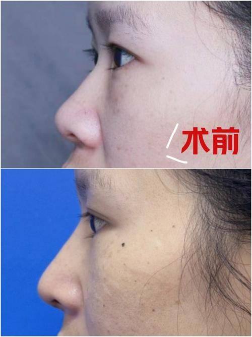 重庆木槿整形美容医院怎么样