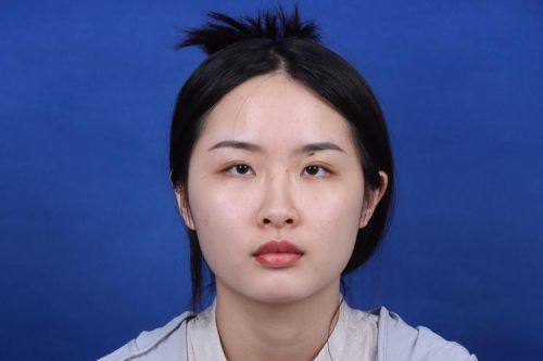 重庆木槿整形美容医院擅长项目