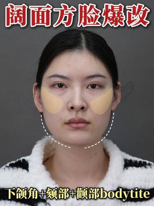 辽宁医学校附属第一医院烧伤整形科价格表：