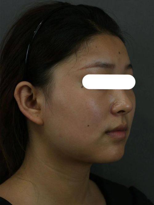 辽宁医学校附属第一医院烧伤整形科擅长项目：