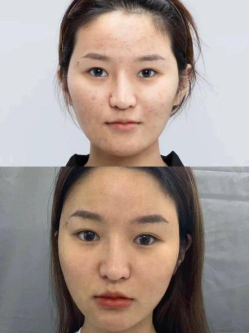 重庆木槿整形美容医院地址电话及营业时间