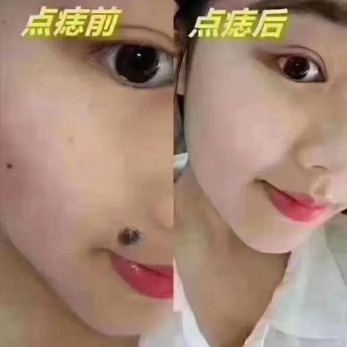 中山市广济医院预约挂号方式: