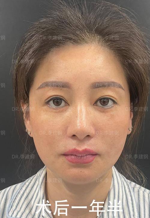 俪伴医院预约挂号方式：