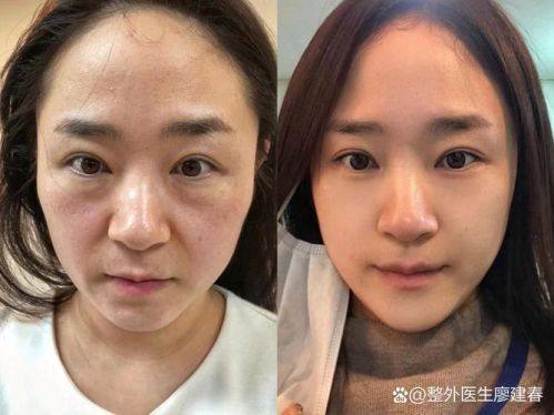 俪伴医院擅长项目：