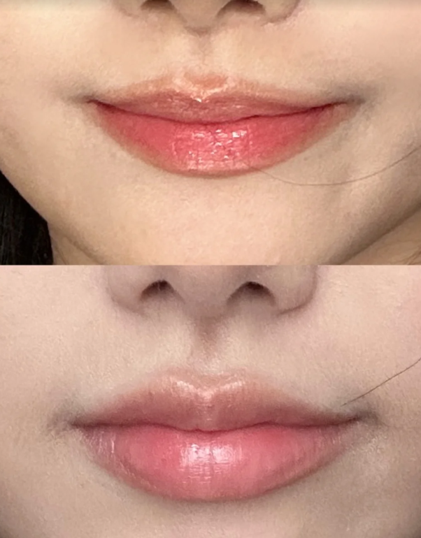 四、手术次数、成效周期与术后护理