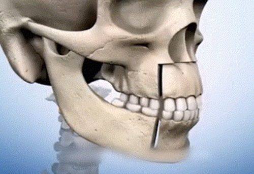 二、怎么去眼袋黑眼圈更有效的方法