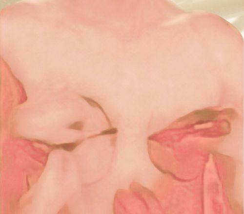 深圳享美瑞尼丝医疗美容诊所口碑评价: