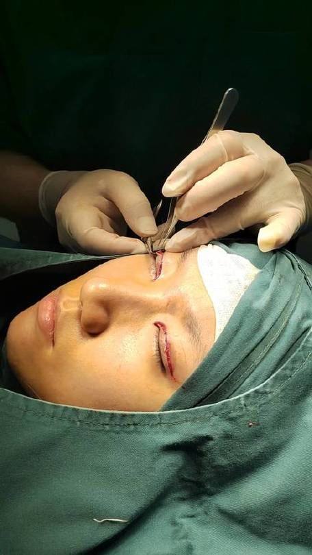 珠海生命元素整形医院擅长项目: