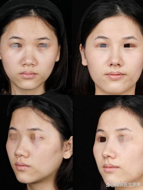 南充嘉陵江整形美容机构擅长项目：