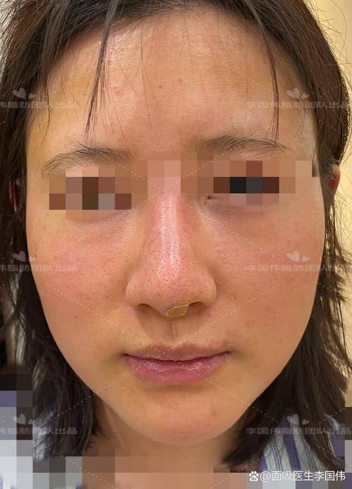 南通爱婍艺整形医院价格表: