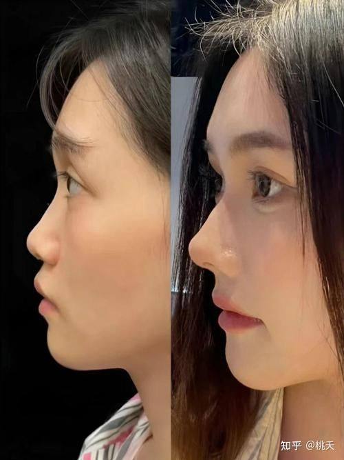 成都高新恩美医疗美容诊所怎么样?