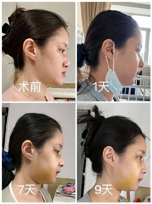 南通爱婍艺整形医院口碑评价: